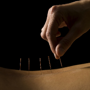 WHO Says Acupuncture Works