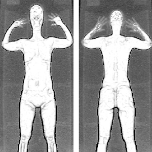 EPIC: Documents Show TSA Ignored Radiation Warnings