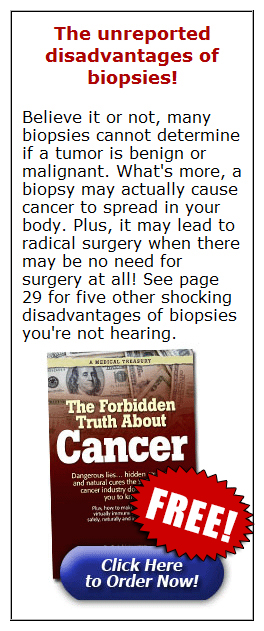 The unreported disadvantages of biopsies!